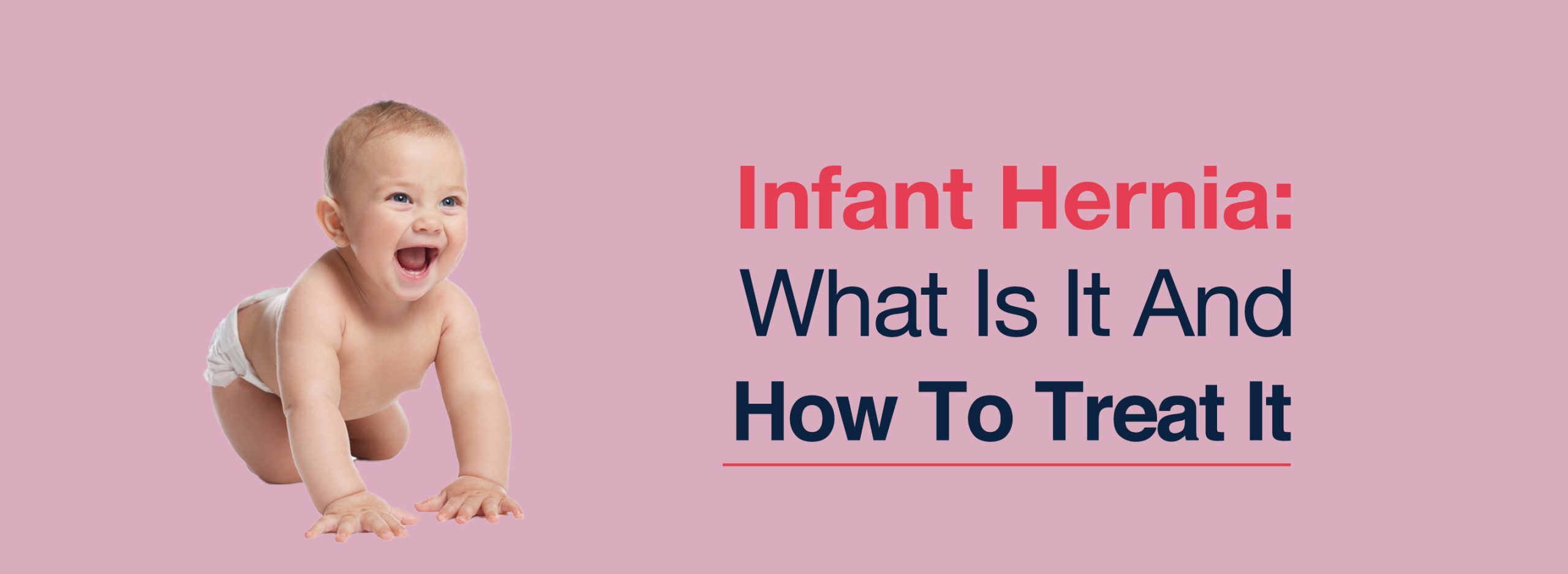 Infant Hernia: What Is It And How To Treat It? 