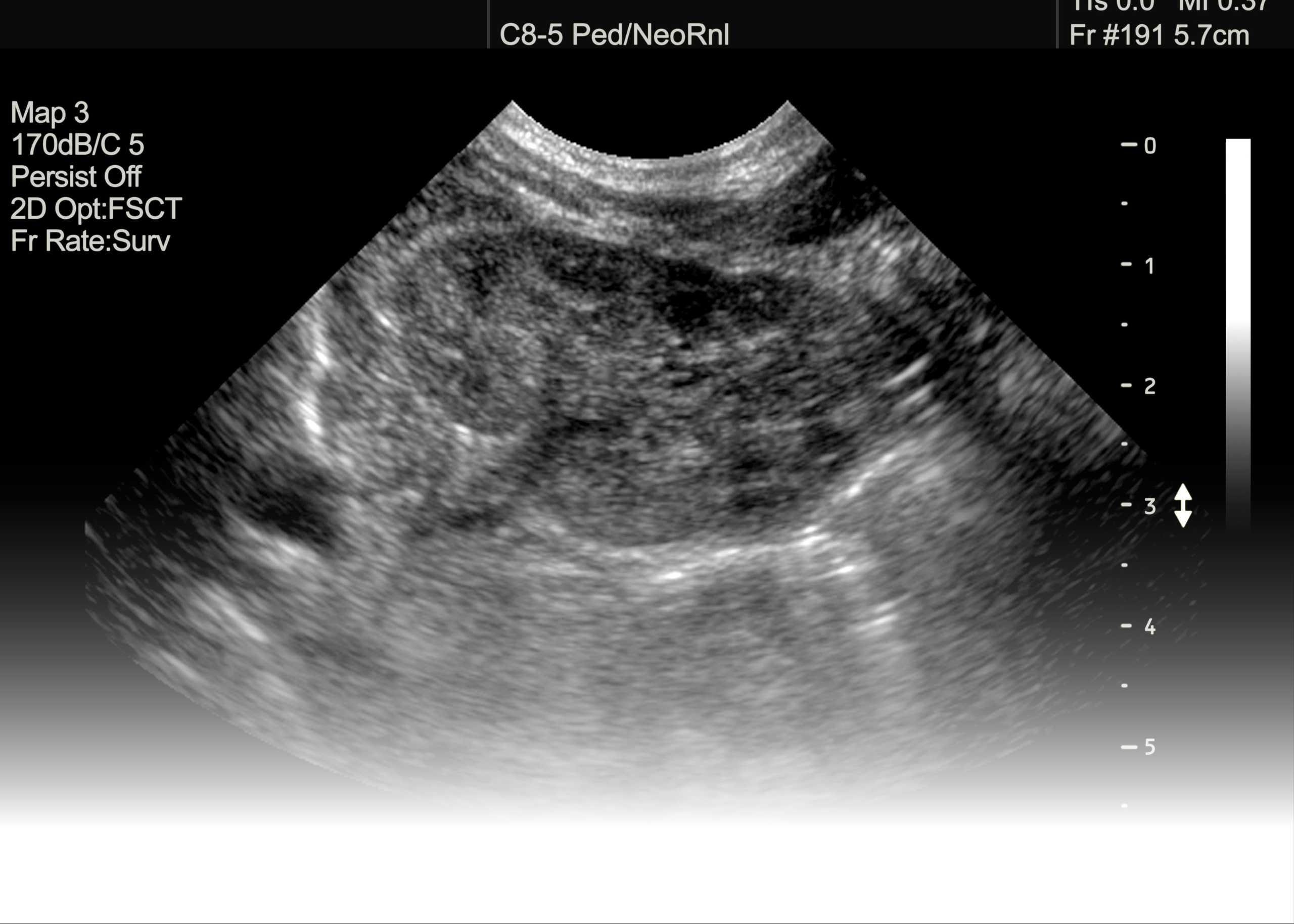Understanding the Sonography Test: A Comprehensive Guide