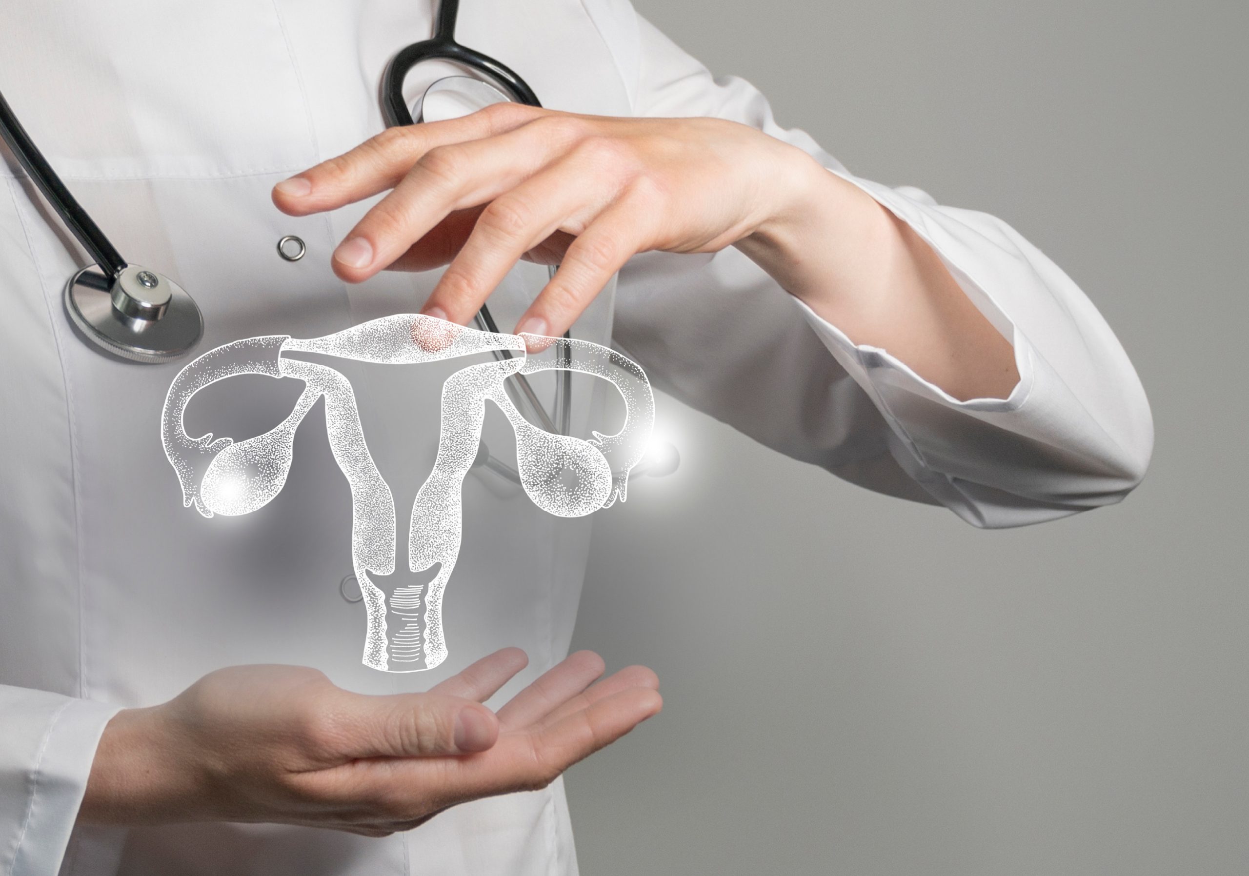 Is Painful Periods Normal? A Gynecologist’s Guide to Endometriosis Signs